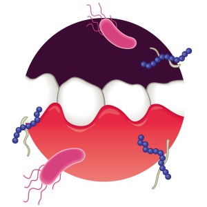 歯の細菌