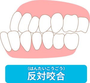 歯並び悪い　体調　影響
