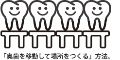 pullout_03