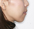 study_14_ph04_01