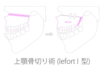 suegery_01