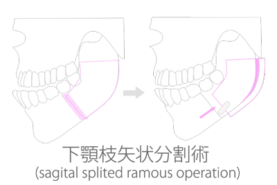surgery_02