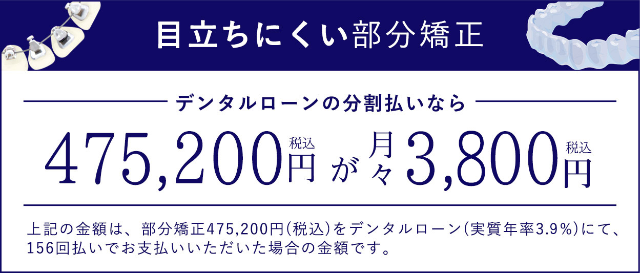 部分矯正月々3,700円