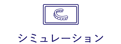 シミュレーション
