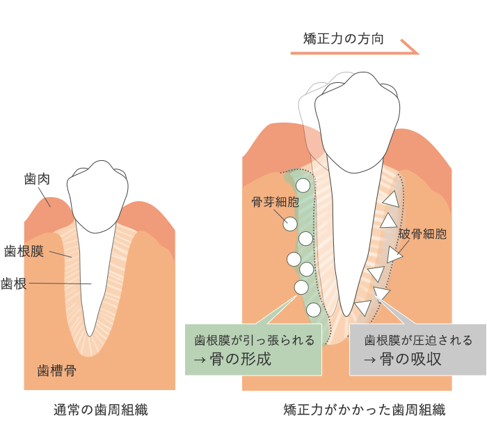 howtopersuade img02 https://sasebo.tv/category/orthodontics/%e3%82%a4%e3%83%b3%e3%83%93%e3%82%b6%e3%83%a9%e3%82%a4%e3%83%b3/invisaline/