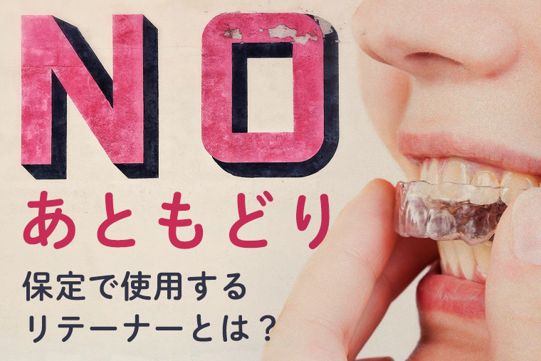 後戻りを起こさないためのリテーナーとは？