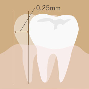 invisalign_f_02