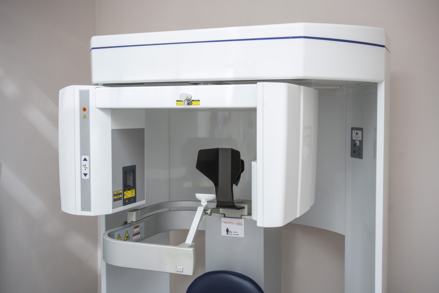 矯正歯科　CT　精密検査