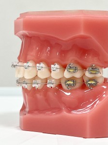 矯正歯科　審美歯科　美容歯科　違いは