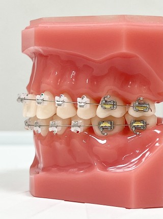裏側矯正　矯正治療　歯列矯正　適応　表側矯正　メリット　デメリット　マウスピース矯正