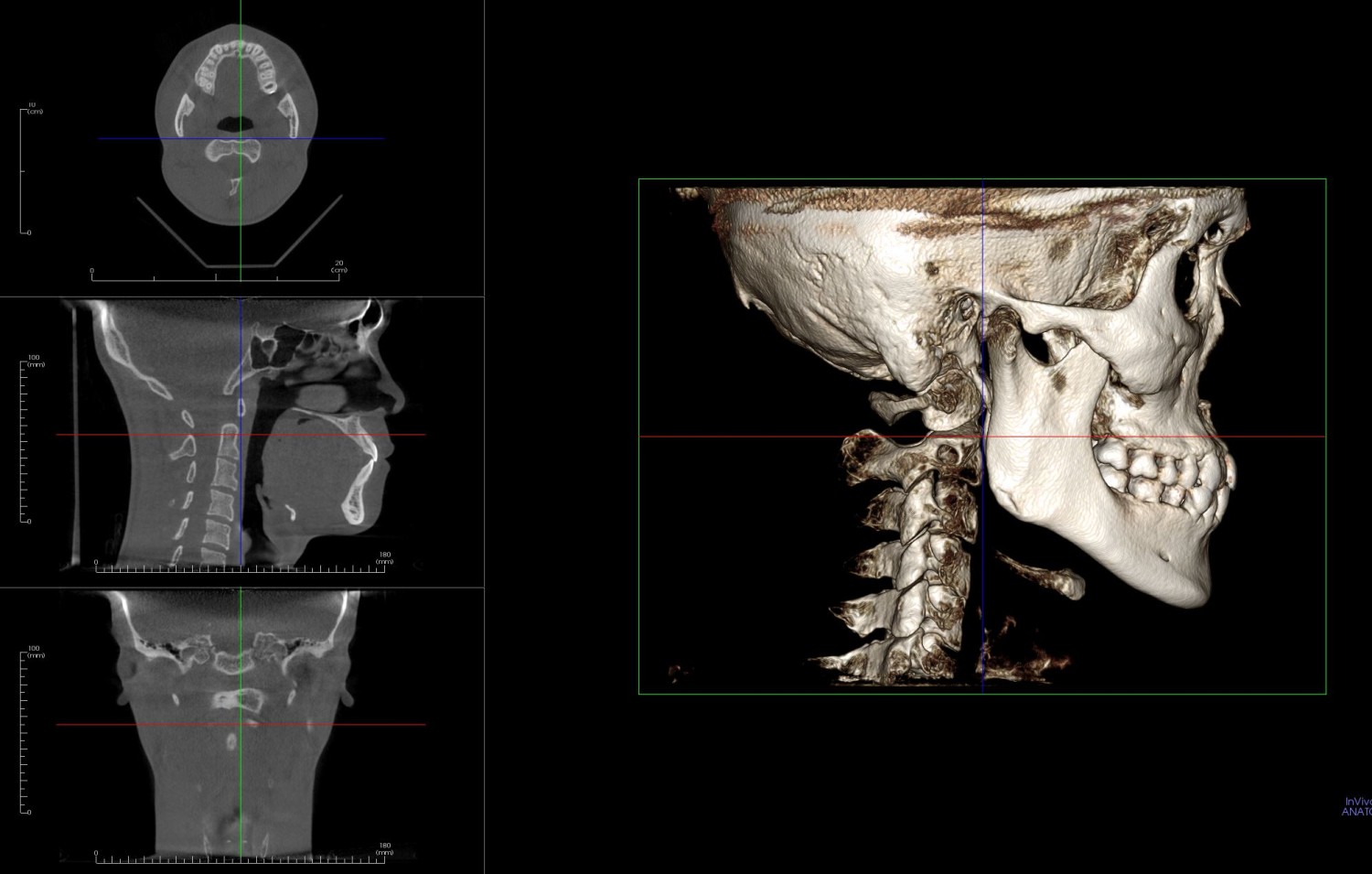 矯正歯科の選び方　CT　認定医