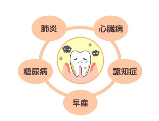 歯周病　全身疾患　健康寿命