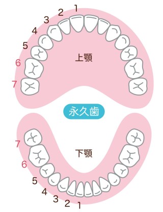 先天性欠如歯　先天性欠損歯　矯正治療