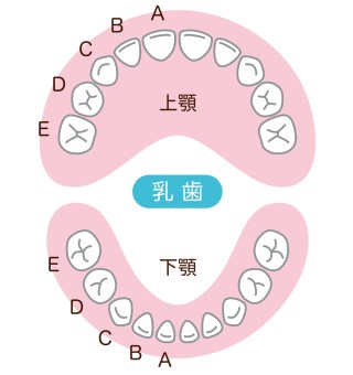 先天性欠如歯　先天性欠損歯　矯正治療