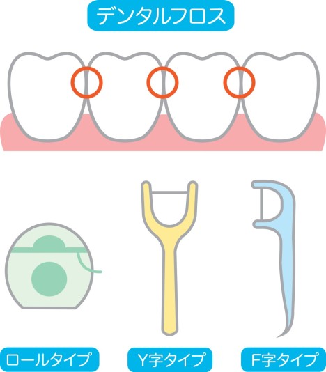 歯列矯正　矯正治療中　デンタルフロス　種類