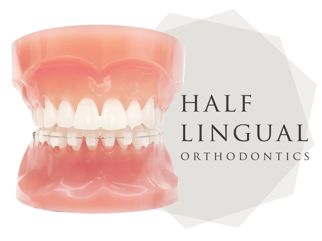 海外留学中だけど日本で矯正治療はできる？－一時帰国・短期滞 在中に進める方法