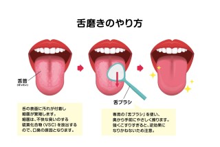 清潔感　口元　歯列矯正 好印象　口臭　舌磨き