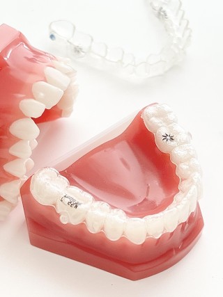 歯並び　どんどん悪くなる　気になる　改善　矯正　治療