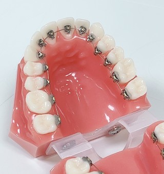 口　形　歯並び　矯正　関係　治療