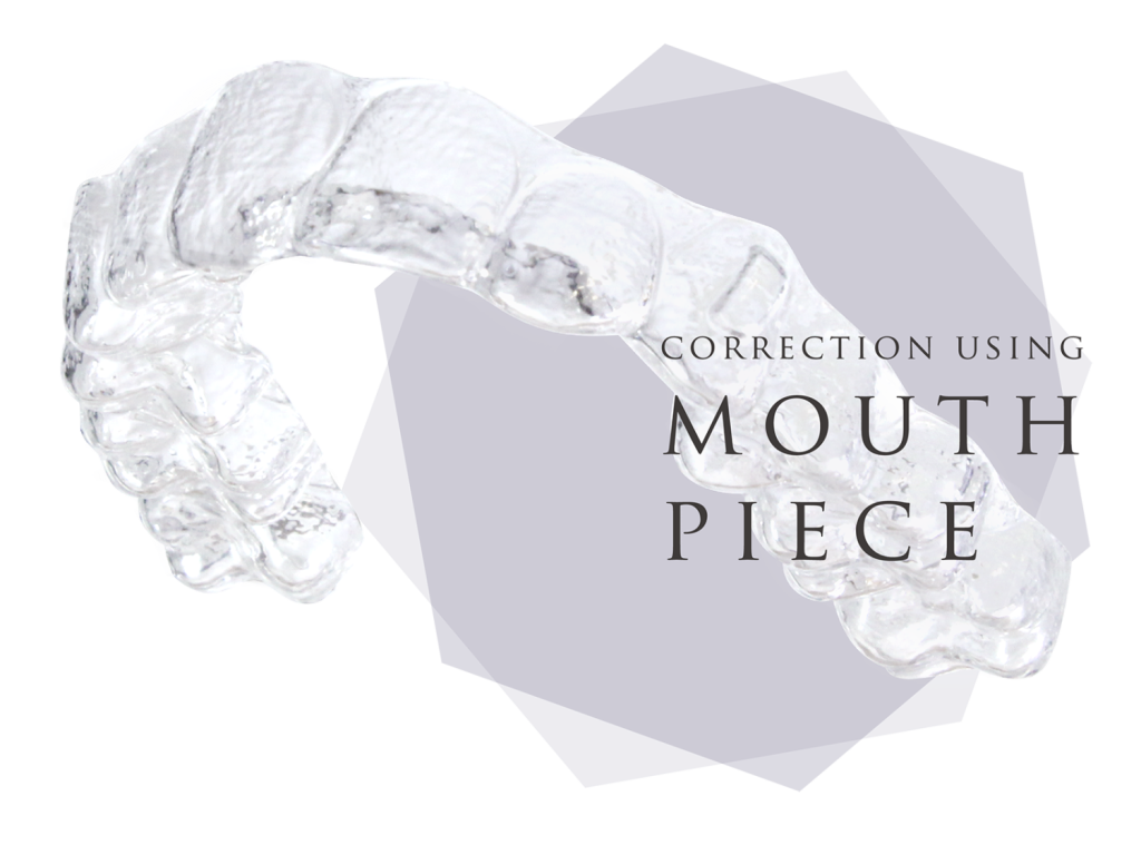 海外留学中だけど日本で矯正治療はできる？－一時帰国・短期滞 在中に進める方法