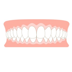 かみ合わせ　矯正　歯列矯正