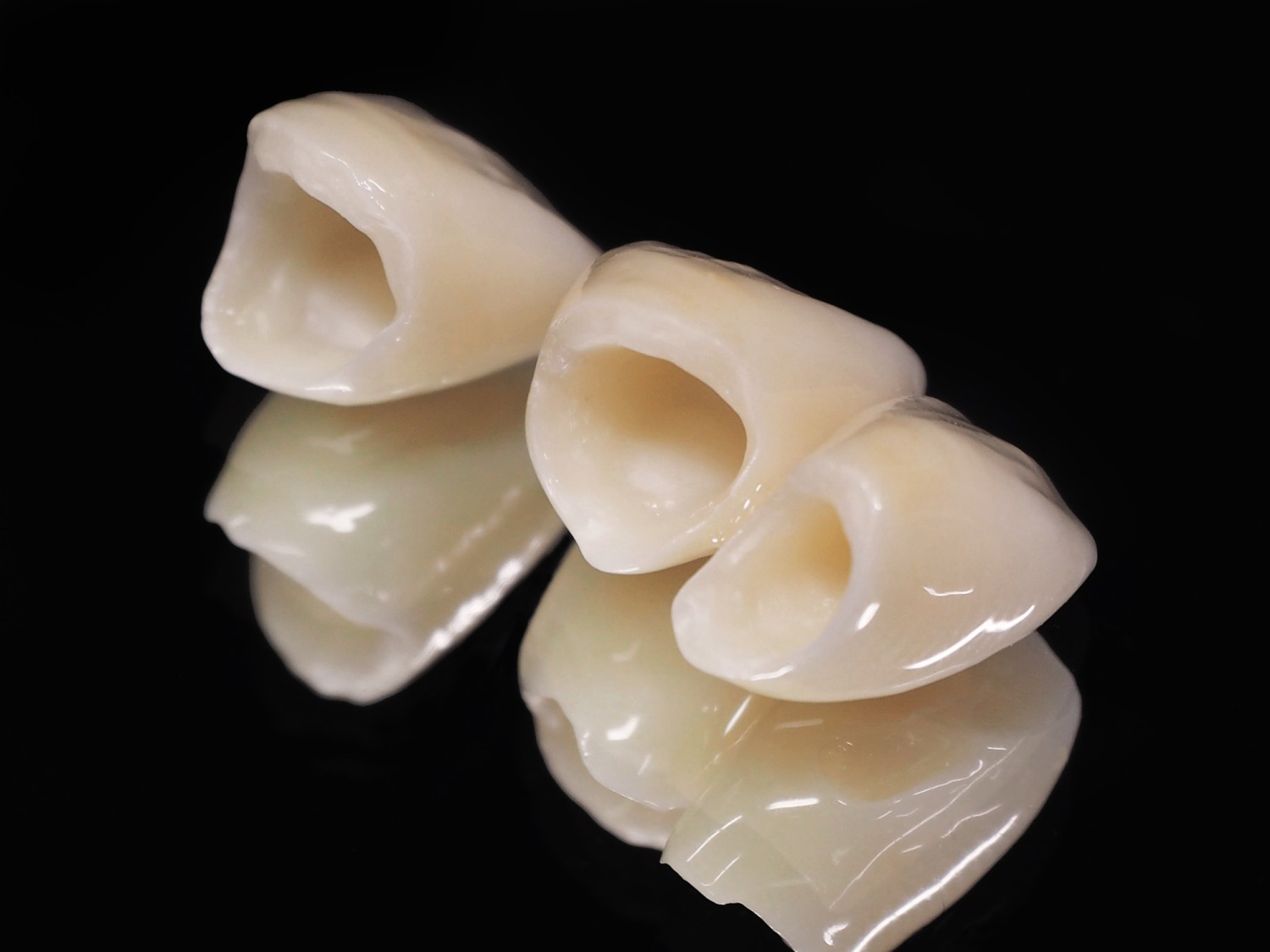 スマイルライン 矯正 美人