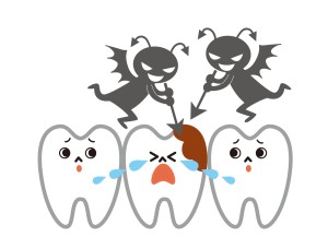 歯列不正　むし歯　虫歯　歯周病