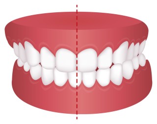 歯列矯正　歯科矯正　矯正治療　必要性　歯並び　チェック