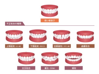 日本人　歯列矯正　矯正　割合　どのくらい