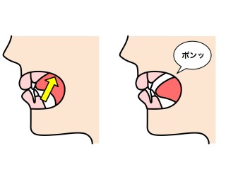 舌癖　矯正