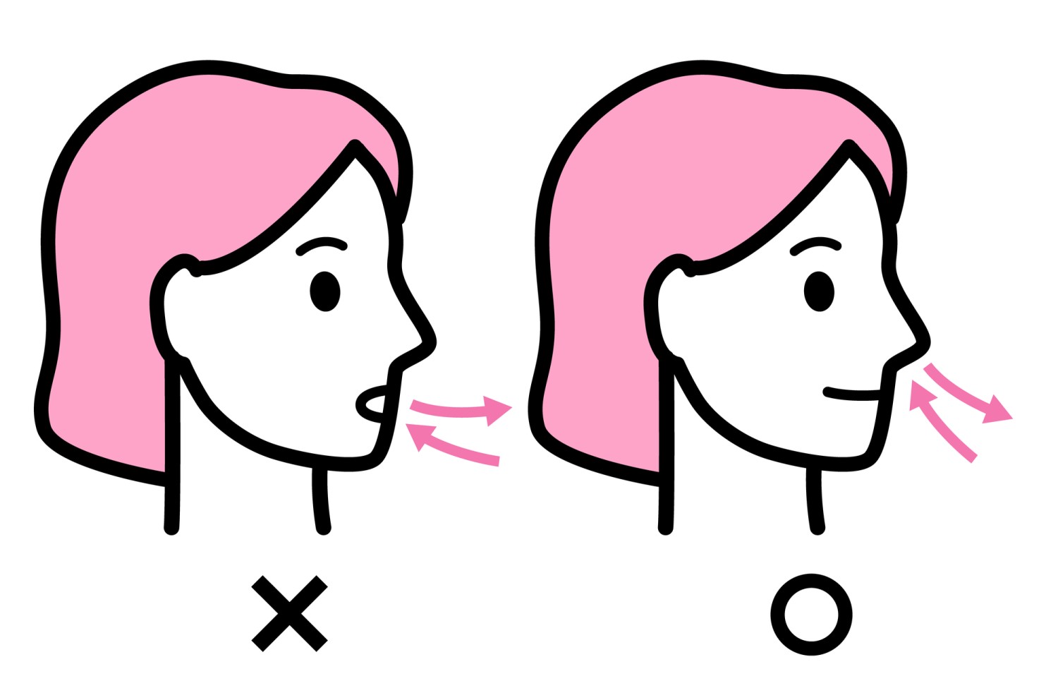 矯正後の保定　舌癖　食いしばり　歯ぎしり　