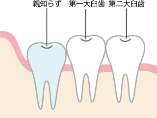 歯並び　どんどん悪くなる　気になる　改善　矯正　治療