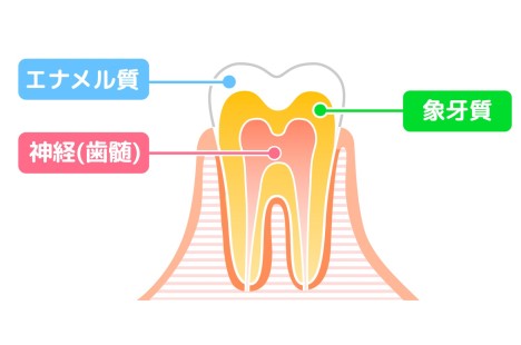 セラミック　歯列矯正　おすすめしない　デメリット　メリット