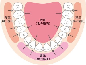 矯正のあと戻り