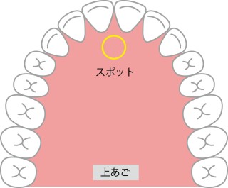 舌の正しいポジション　舌の正しい位置　横浜駅前歯科矯正歯科