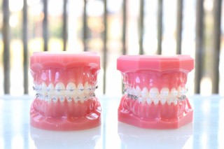 歯科矯正　期間を早める　効果を高める　コツ　ポイント　解説