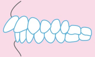 口　形　歯並び　矯正　関係　治療