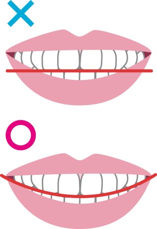 キレイ　笑顔　スマイル　条件　矯正