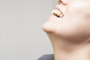出っ歯の人はほうれい線ができやすい？