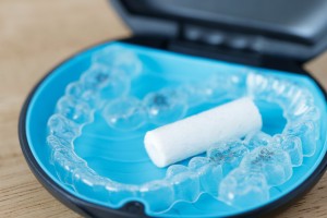 矯正治療のカウンセリングで何を話す？｜成功のためには事前準備が大切　舌癖　食いしばり　歯ぎしり