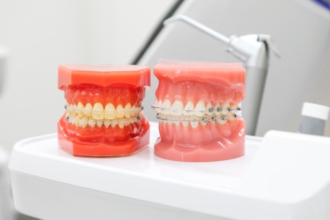 矯正歯科　比較　検討　ポイント