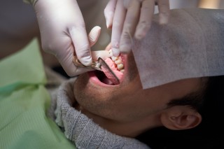 歯科矯正　つらい　時期