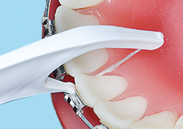 歯列矯正　矯正治療　デンタルフロス　プラティパス