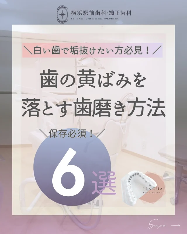 .
.
こんにちは🤍
横浜駅前歯科・矯正歯科です💐

今回は歯の着色を落とす方法についてまとめました💎

ぜひご覧ください🎵

﹏﹏﹏﹏﹏﹏﹏﹏
歯にお悩みがある方✨
無料のカウンセリングにてご相談ください🌱

🟡ご予約方法
24hネット予約可能🖥⇓
プロフィール欄に記載のURLよりご覧ください✨

お電話はこちら💁‍♀️⇓
📞0120-418-139

🌿クリニック
横浜駅西口徒歩3分

#矯正歯科
#裏側矯正
#横浜西口
#矯正認定医
#横浜駅前歯科矯正歯科
#渋谷矯正歯科グループ