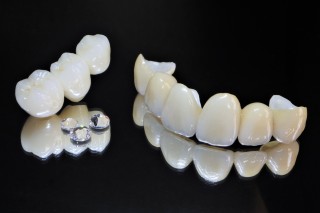 ガミースマイル　ガミー　逆ガミー　矯正　歯列矯正　改善　装置　