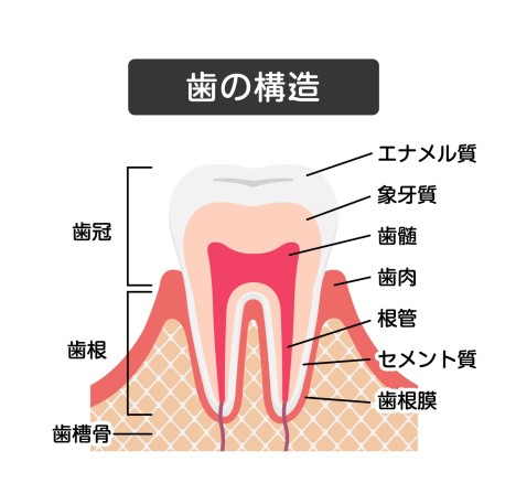 歯の構造　エナメル質が酸で溶ける　酸蝕症
