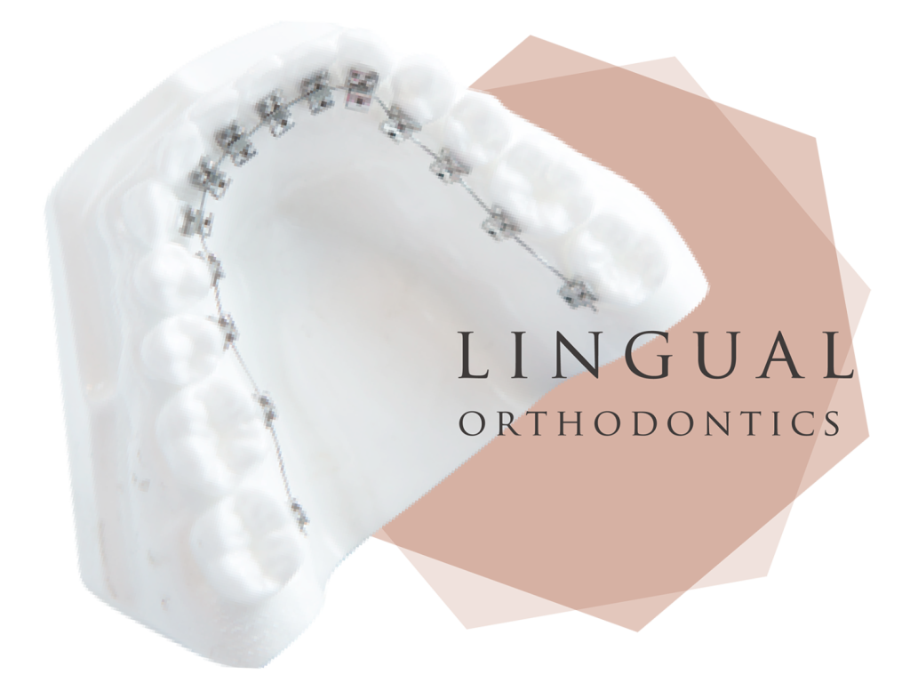 海外留学中だけど日本で矯正治療はできる？－一時帰国・短期滞 在中に進める方法