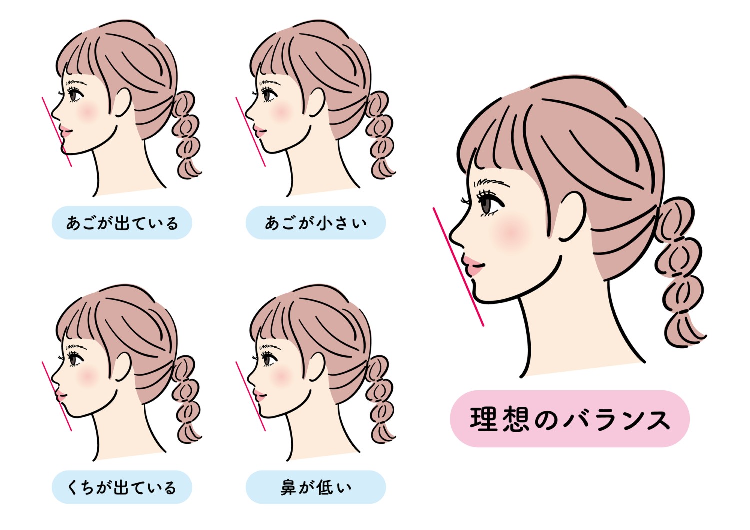 Eライン　口元下げる　出っ歯　理想のバランス